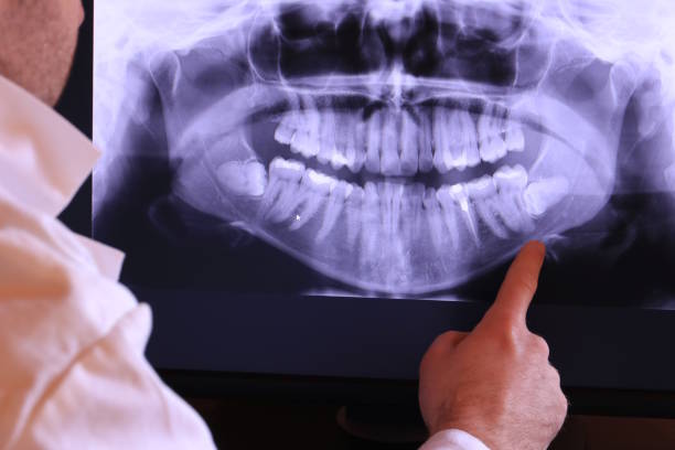 Best Walk-In Emergency Dentist in Baldwin, GA