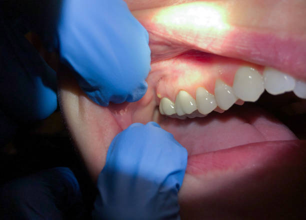 Best Emergency Treatment for Toothache in Baldwin, GA